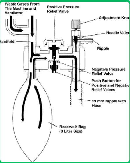 Anesthesia Unit Gas Scavenger System (AGSS) schematic and system components